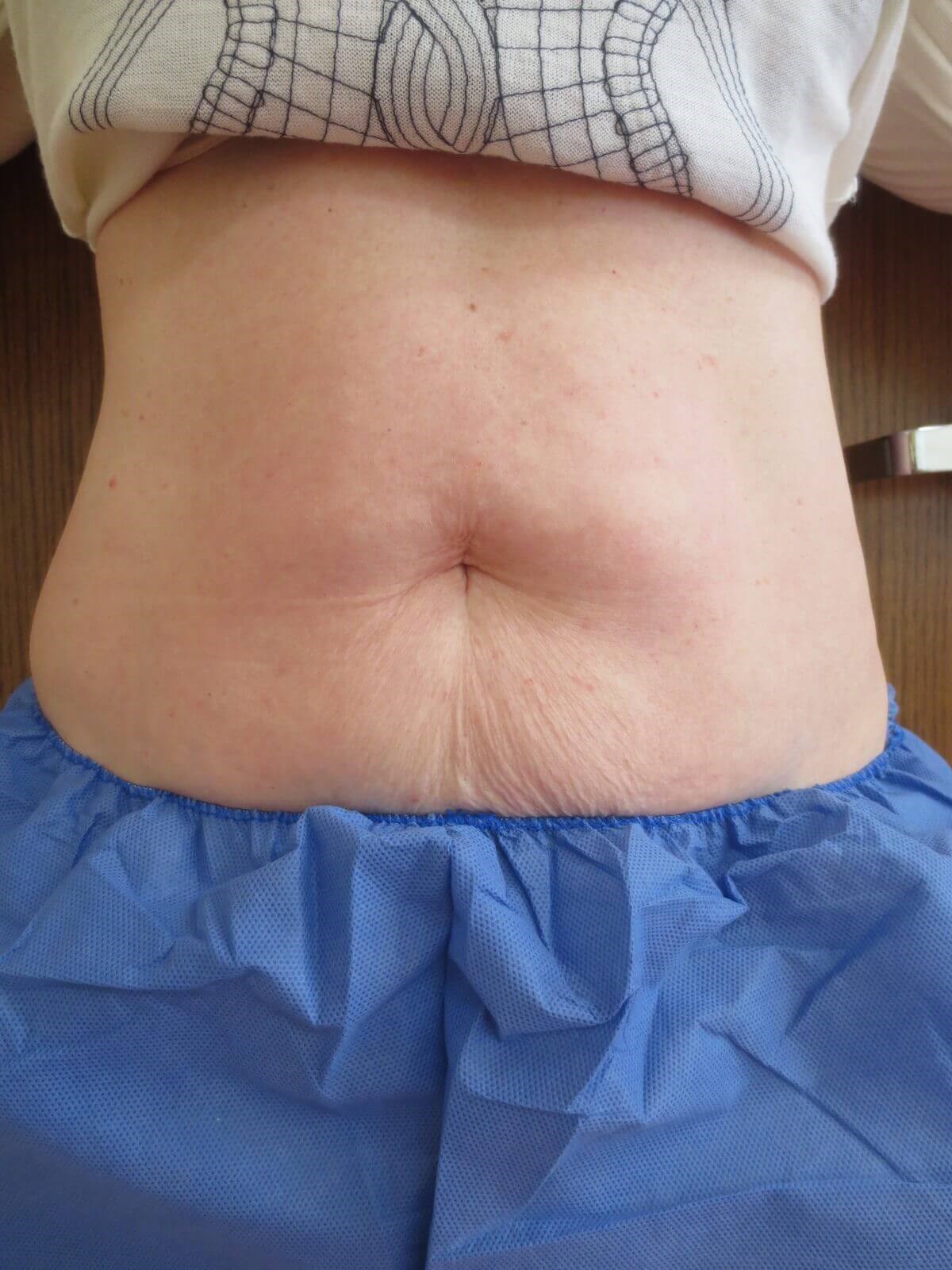 After Image