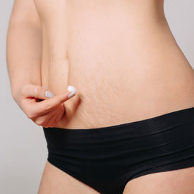 Forma RF Skin Tightening
